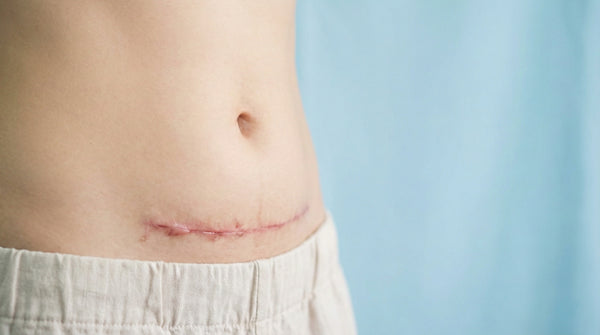 Post-Surgical Recovery